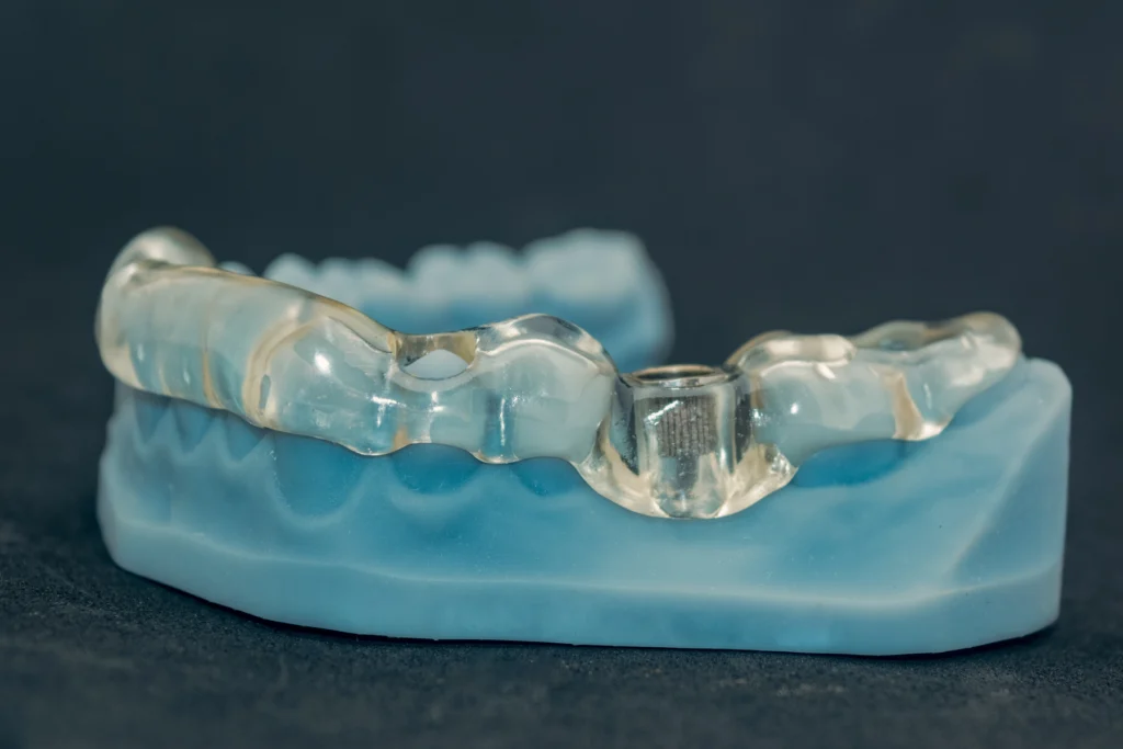 chirurgie guidee montpellier Implants dentaires Eurêka dentaire - Chirurgiens-dentistes à Castelnau-le-Lez