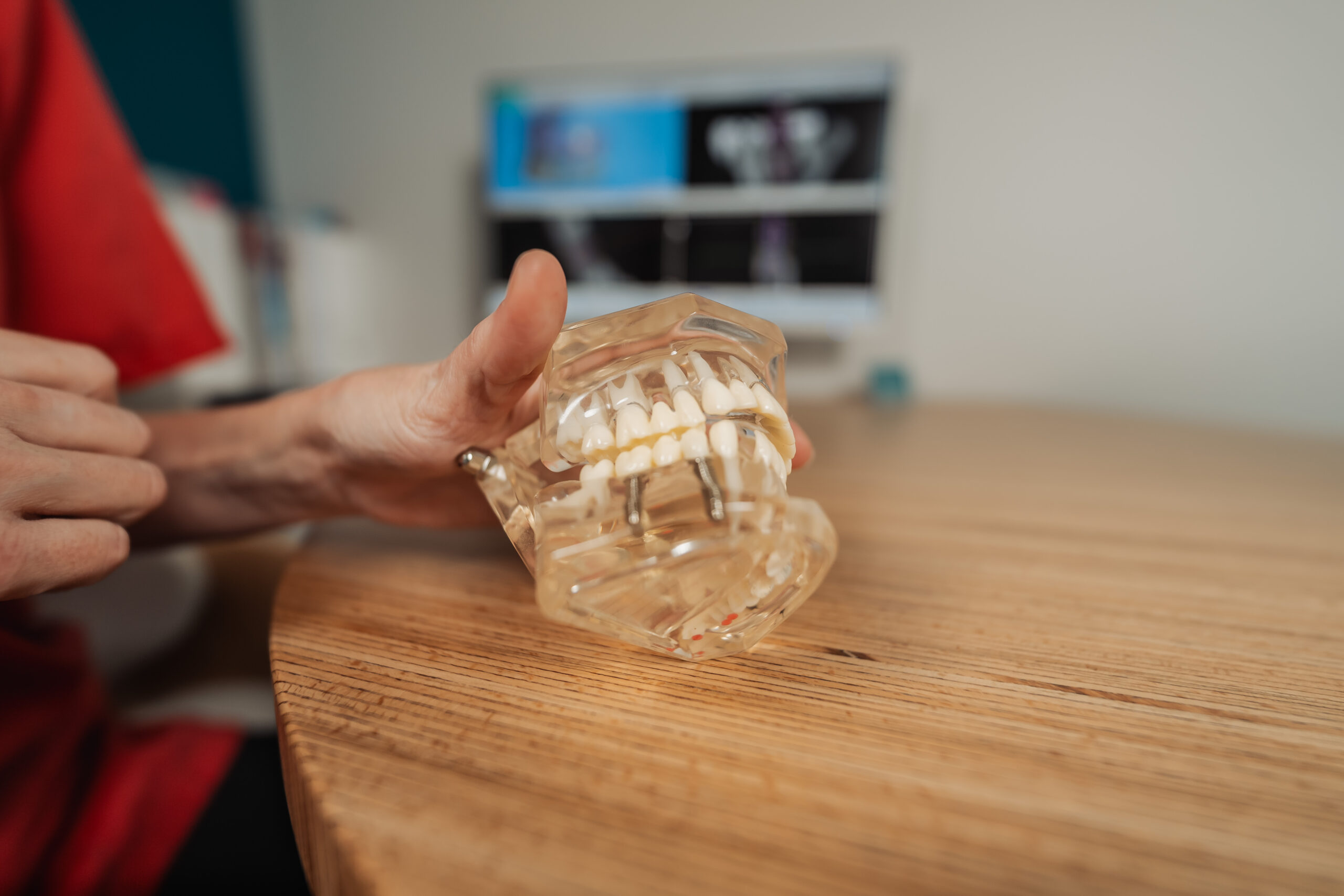 extraction dent sagesse complexe montferrier sur lez scaled Implants dentaires Eurêka dentaire - Chirurgiens-dentistes à Castelnau-le-Lez